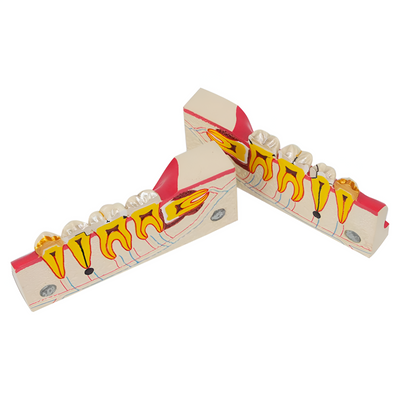 MODELO KINGDEN 1/4 DE ARCADA 3ER MOLAR IMPACTADO INF