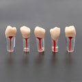 1X10 DIENTE P/ENDODONCIA KINGDEN C/RAIZ JGO