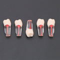 1X10 DIENTE P/ENDODONCIA KINGDEN C/RAIZ JGO