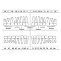 1X10 DIENTE P/ENDODONCIA KINGDEN C/RAIZ JGO