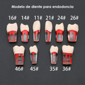 1X10 DIENTE P/ENDODONCIA KINGDEN C/RAIZ JGO