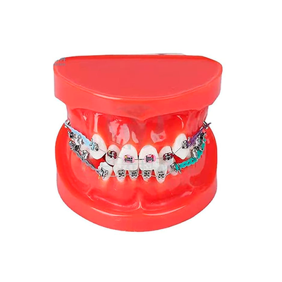 TIPODONTO KINGDEN MALA OCLUSION C/BRACKET