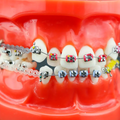 TIPODONTO KINGDEN MALA OCLUSION C/BRACKET
