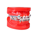 TIPODONTO KINGDEN MALA OCLUSION C/BRACKET