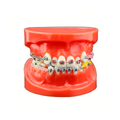 TIPODONTO KINGDEN MALA OCLUSION C/BRACKET