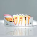 MODELO KINGDEN 1/4 DE ARCADA 3ER MOLAR IMPACTADO INF
