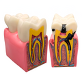 MODELO DENTAL KINGDEN CARIES S/PATOLOGIAS