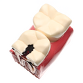 MODELO DENTAL KINGDEN CARIES S/PATOLOGIAS